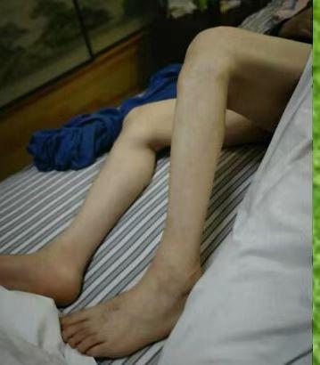 0924我的康复之路2.jpg