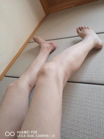 0924我的康复之路4.jpg