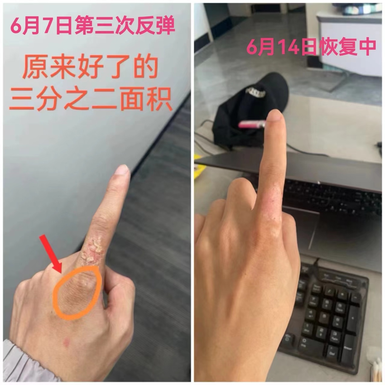 0617当恩师临在于身心中时出现的奇迹2.jpeg