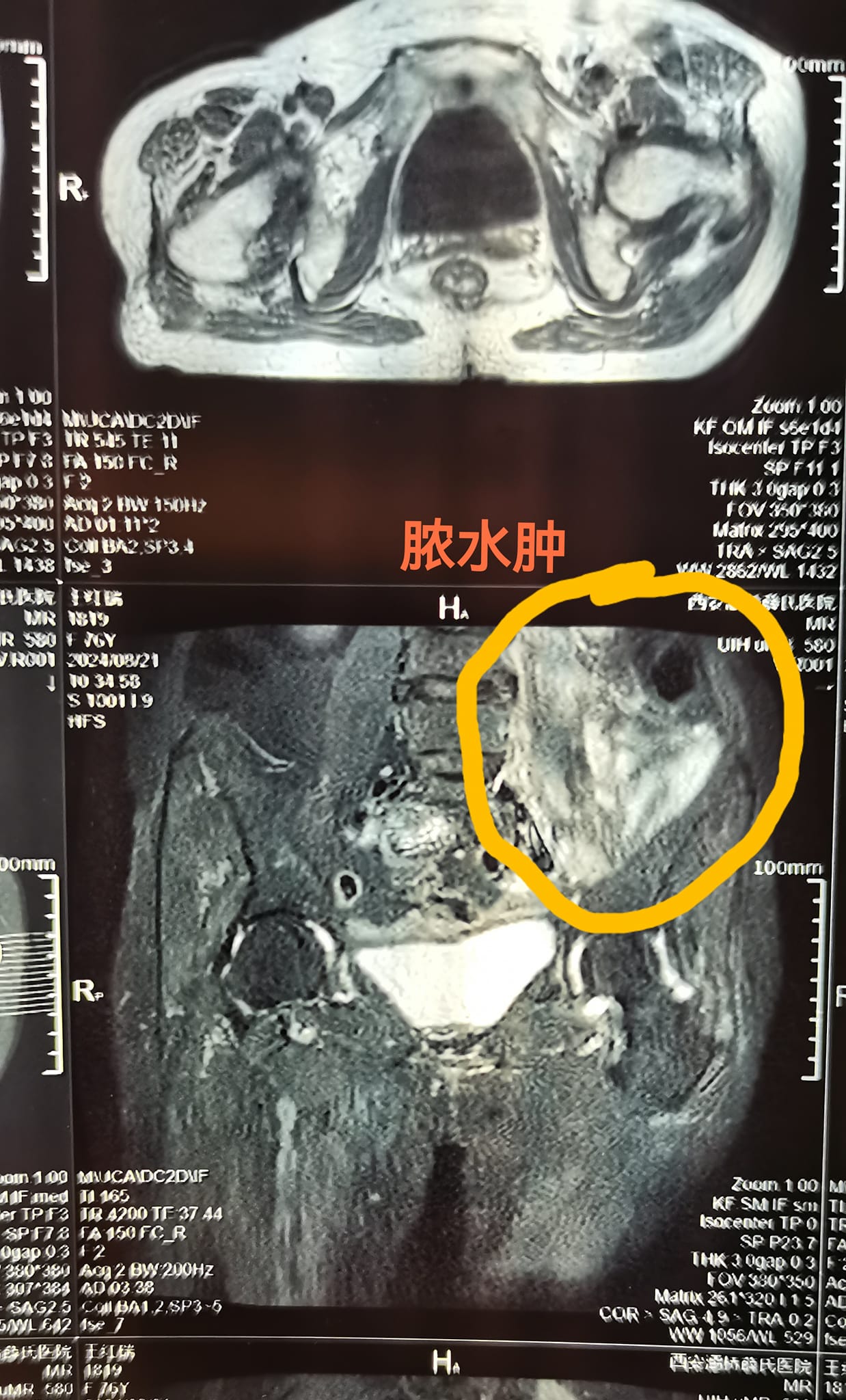 1014老娘的奇迹2.jpg