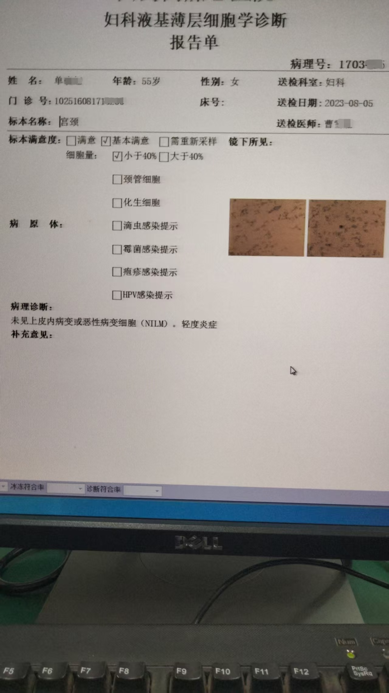 1231我有癌症5.jpg