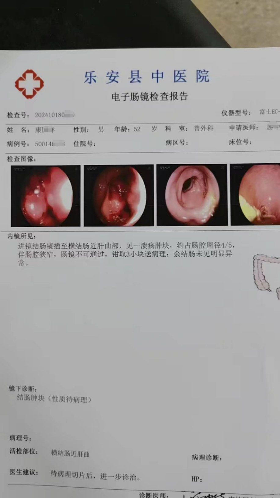 0410-肠癌化疗六次，听法半年康复3.png