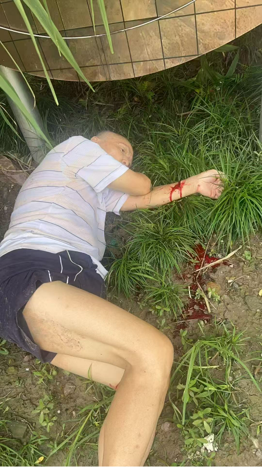0807食道癌晚期患者割腕自杀后的神迹！！！1.png